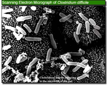 micrograph of Clostridium difficle